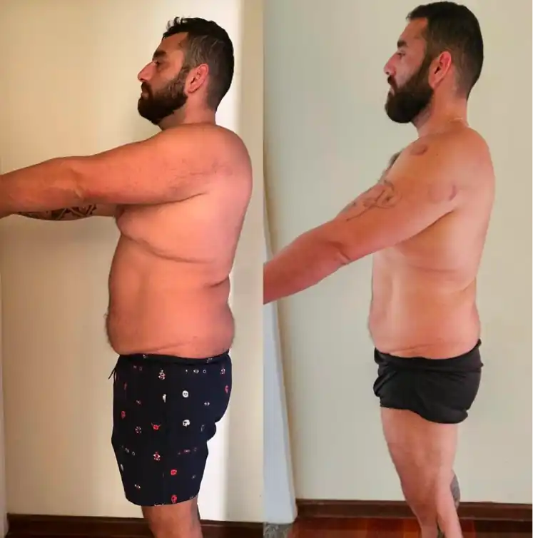 ANTES DEPOIS 9